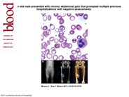 Basophilic stippling: a lead to the diagnosis