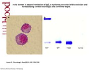 Meningeal myelomatosis