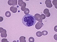 Monocyte - 1.