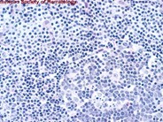 Normal Lymphoid Tissues: Part 2 - 12.