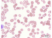 Stomatocytes
