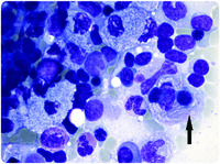 “Atypical” macrophages