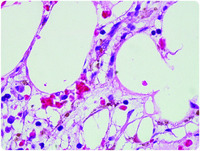 Unwelcome passengers