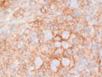 GZL PD-L1 IHC