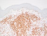 CD3 IHC CMZL
