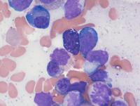 Mast cell (normal)