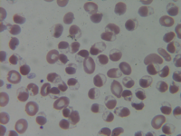 Erythrocyte Hemighosts Cells