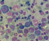 Giant band cell