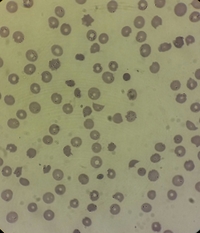 Helmet cell