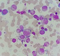 Leishmania visualization on bone marrow aspiration sample 3