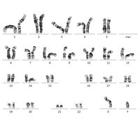 Image showing metaphase, processed metaphase and Karyotype 3