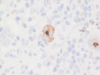 CHLNS CD15