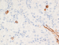 JMML-CD34