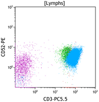 T-Prolymphocytic leukemia