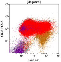 Myeloid Neoplasm-GATA2