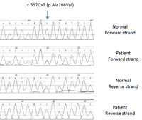 Myeloid Neoplasm-GATA2-Sanger