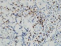 HVLPD-CD3