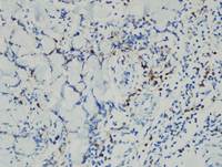HVLPD-CD4
