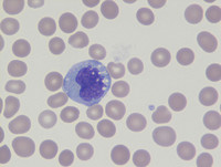 Monocyte