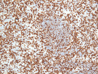 EBV reactivation-CD5