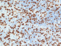 EBV reactivation