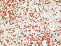 ALCL-CD3