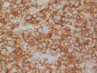 ALCL-CD4