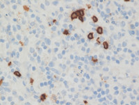 ALCL-CD8