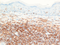 PCSMTL- CD4