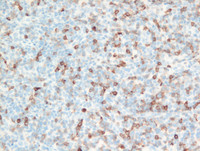 PCSMTL- CD7