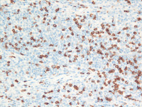 PCSMTL- CD8