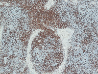 PCSMTL- CD20