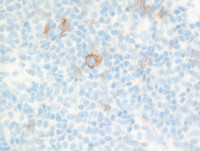 PCSMTL- CD30