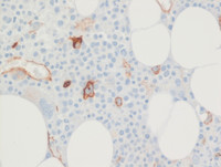 MDS-RS-MLD-CD34 stain