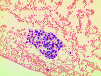 Endothelial cells 2