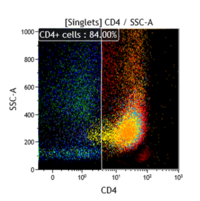 Acute monocytic leukemia 3