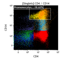 Acute monocytic leukemia 4