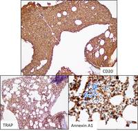 HCL Immunostains