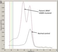 HCL: Molecular findings