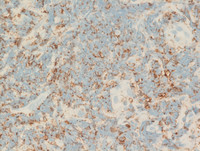 IHC CD5