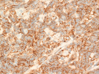 IHC CD10