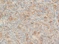 IHC CD1a