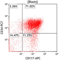 AML with recurrent t(3;3)