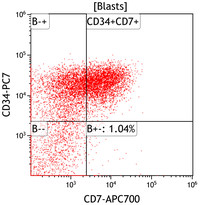 AML with recurrent t(3;3)