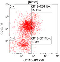 AML with recurrent t(3;3)