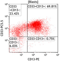 AML with recurrent t(3;3)