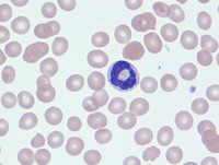 Ring Neutrophil Wright Giemsa