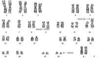 Karyotype using GTG banding