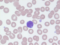 Mycosis Fungoides Blood