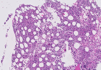 CML-Accelerated Phase-H&E